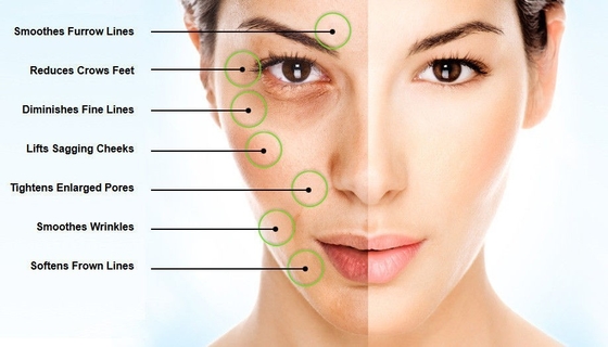 Acide hyaluronique de soins de la peau poudre 15000-50000 Dalton Retain Moisture